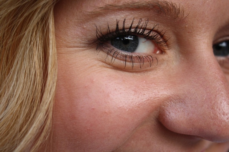 Zmarszczki kurze łapki wokół oczu – jak je usunąć?